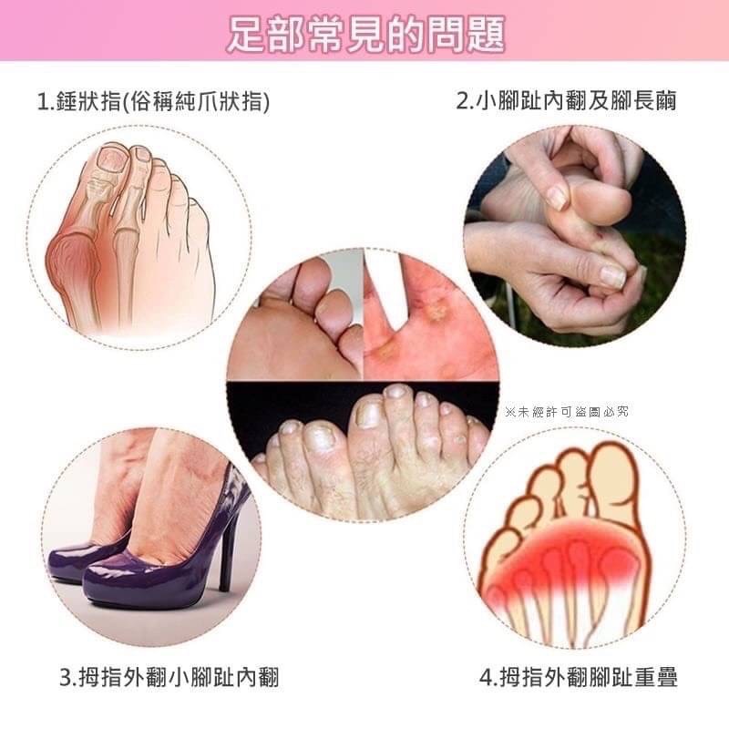 出清‼️美腿分趾套 COSME NO.1 大山式 女人我最大 Kevin老師分享👍👍-細節圖10