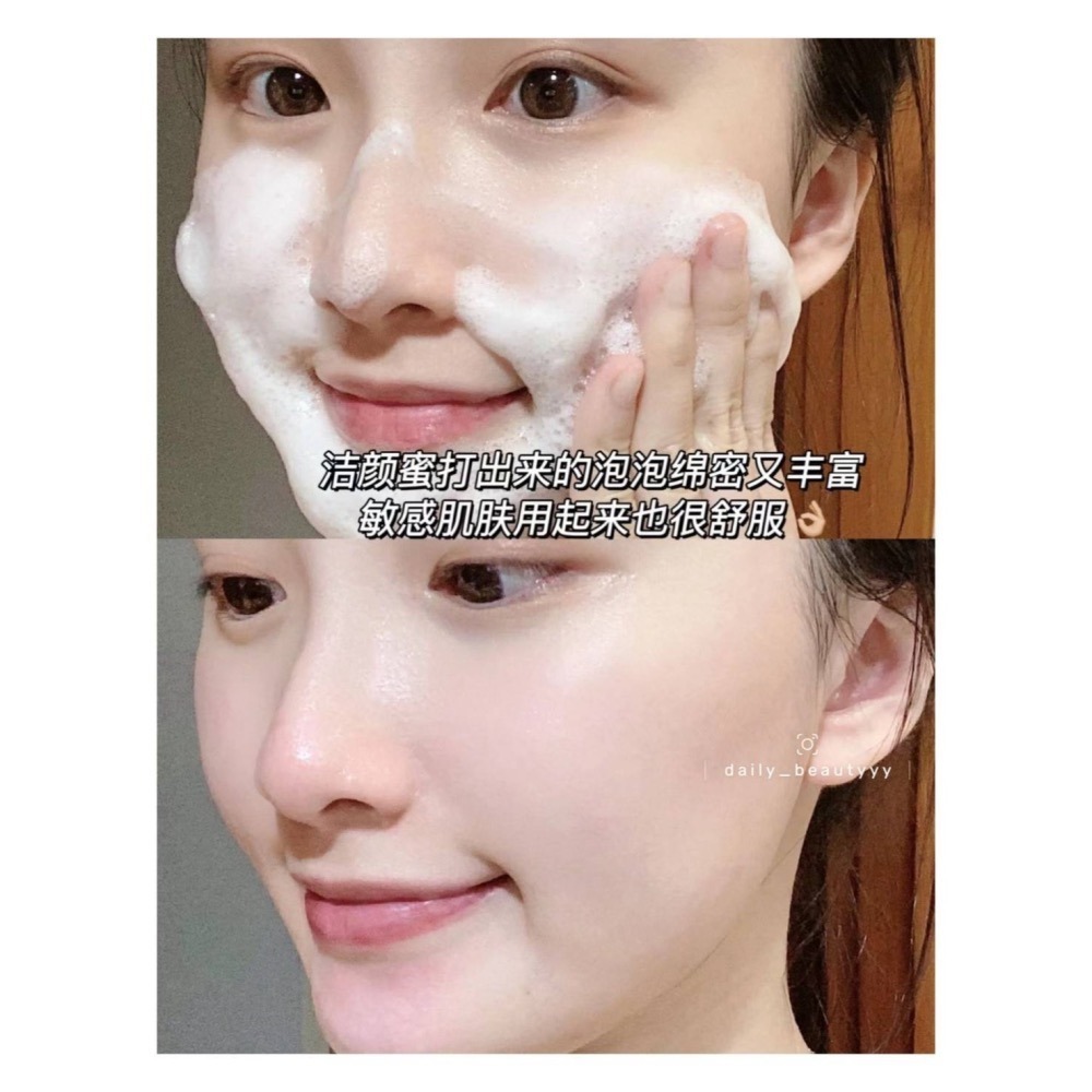 戴栗ლ 小迷糊 Mihoo 潔顏蜜💖毛孔終於洗乾淨了-細節圖5