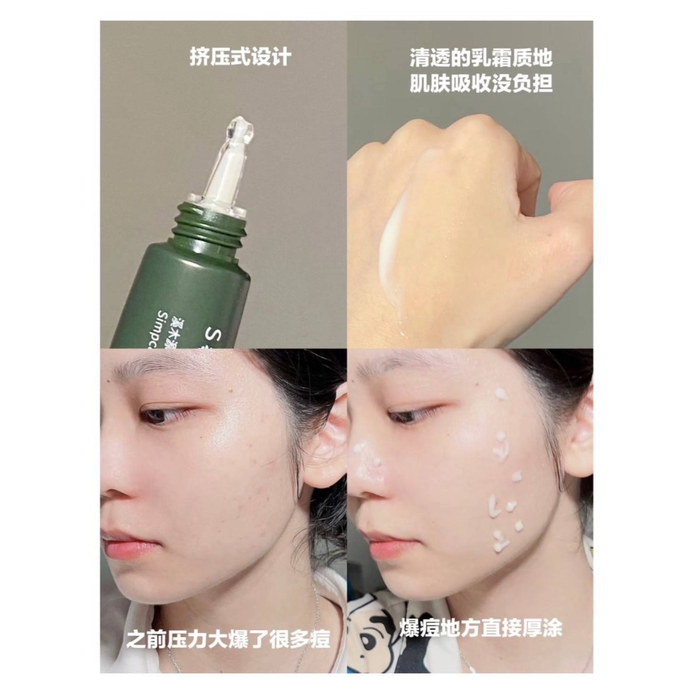 戴栗ლ溪木源愈創木去痘精華·去痘膏·愈創木面膜·痘痘一鍋端-細節圖5