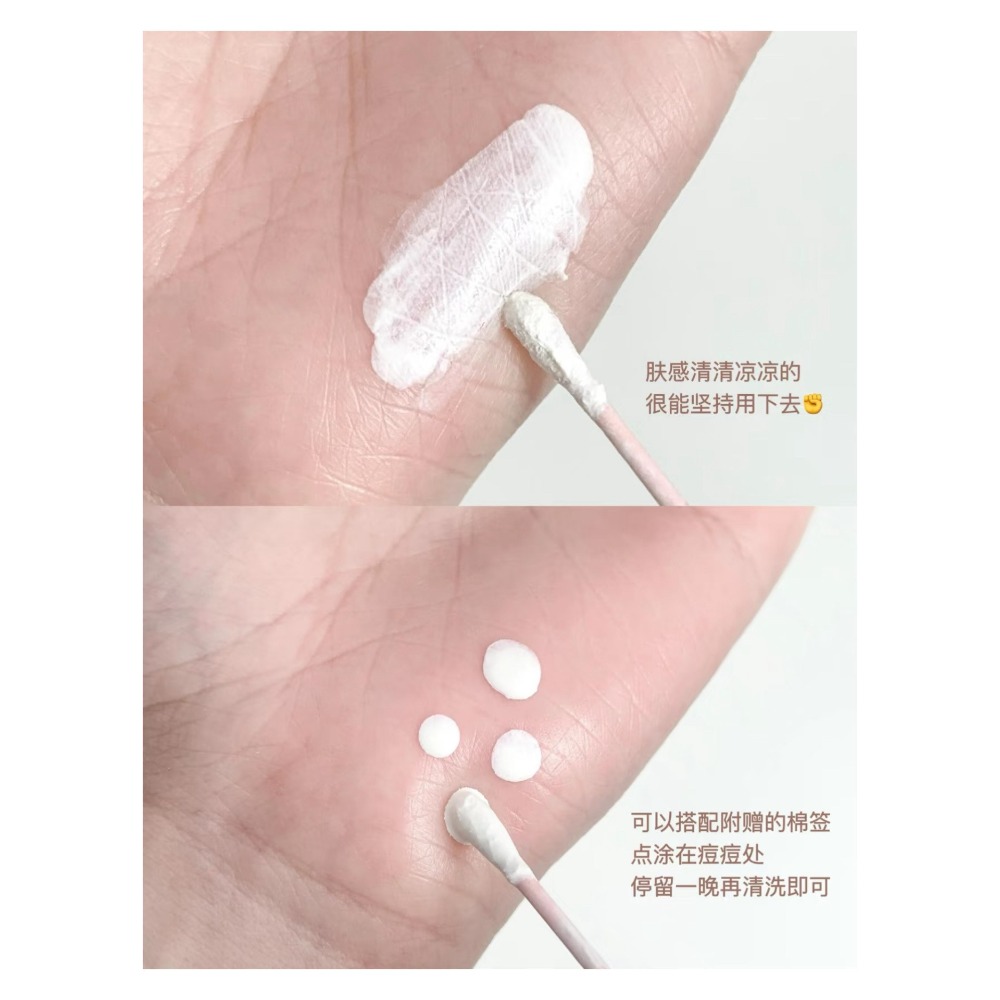 戴栗ლ大水滴 ʙɪɢ ᴅʀᴏᴘ去痘精華 1.0/2.0🩵-細節圖8