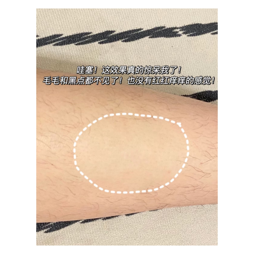 戴栗ლ 水之蔻ᴡᴀᴛᴇʀ ᴄᴏᴍᴇ脫毛膏🥝爆改獼猴桃女孩-細節圖10