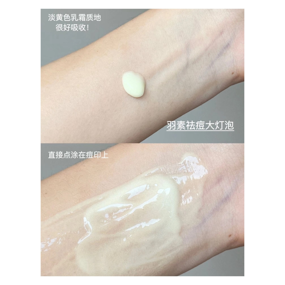 戴栗ლ 羽素 ʏᴏᴜ&ᴘᴜʀᴇ 💡大燈泡2.0/閉口水/反復痘精華/去痘面膜💡痘痘閉口連夜打包回家-細節圖4