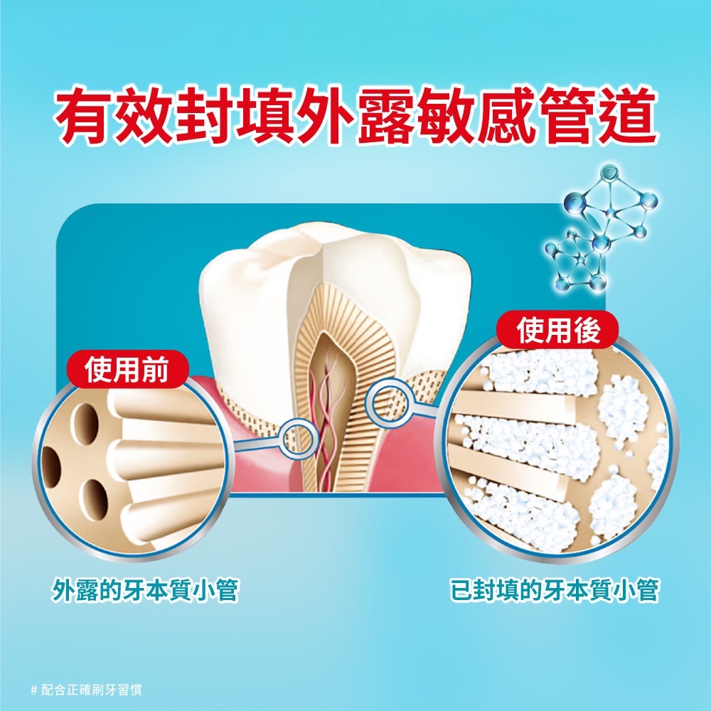 🔥 Colgate 高露潔 抗敏專家 牙膏 長效抗敏 單條 110g-細節圖2