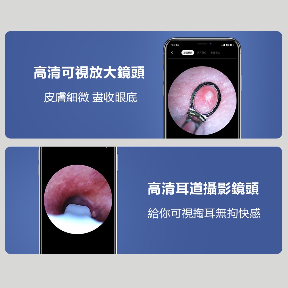 【SUNUO】 可視採耳棒 (深藍) 二合一多功能 奢華採耳 可視 掏耳機 掏耳神器 首創可伸縮式鏡頭-細節圖6