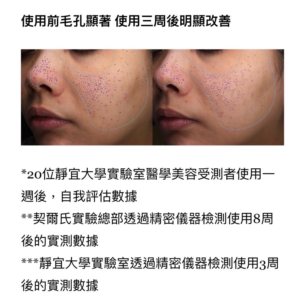 【A’sD 貨到下單】KIEHL’S 契爾氏A醇全能新生抗痕精華-細節圖5