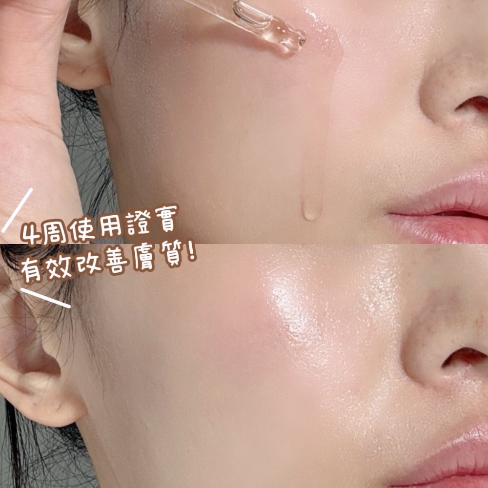 現貨【西歐雜貨店】韓國🇰🇷DEMAR 3 毛孔收縮精萃安瓶 170ml-細節圖6