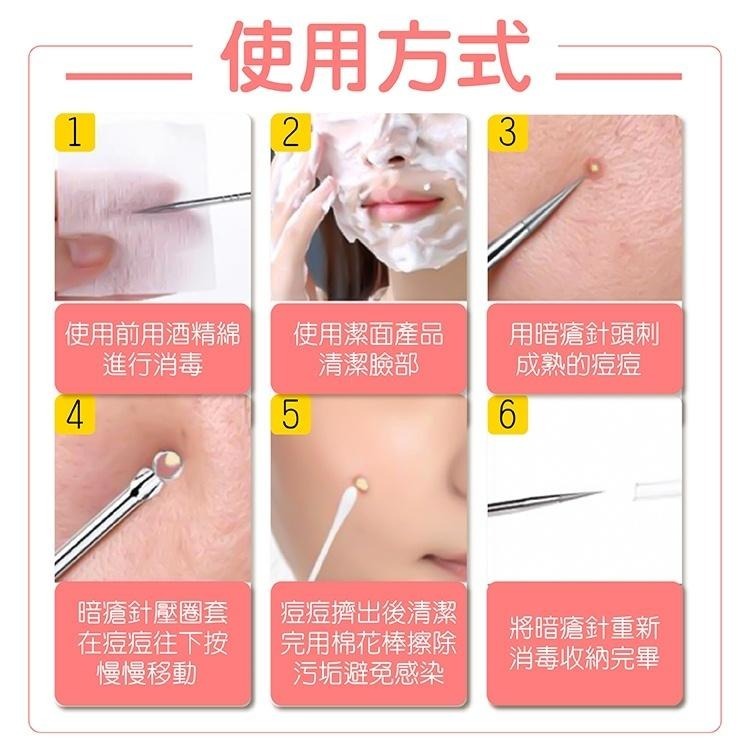 粉刺針 4件組【小麥購物】【C254】挑痘針 美容夾針 粉刺組 粉刺 去黑頭 粉刺棒 清潔 潔面-細節圖6