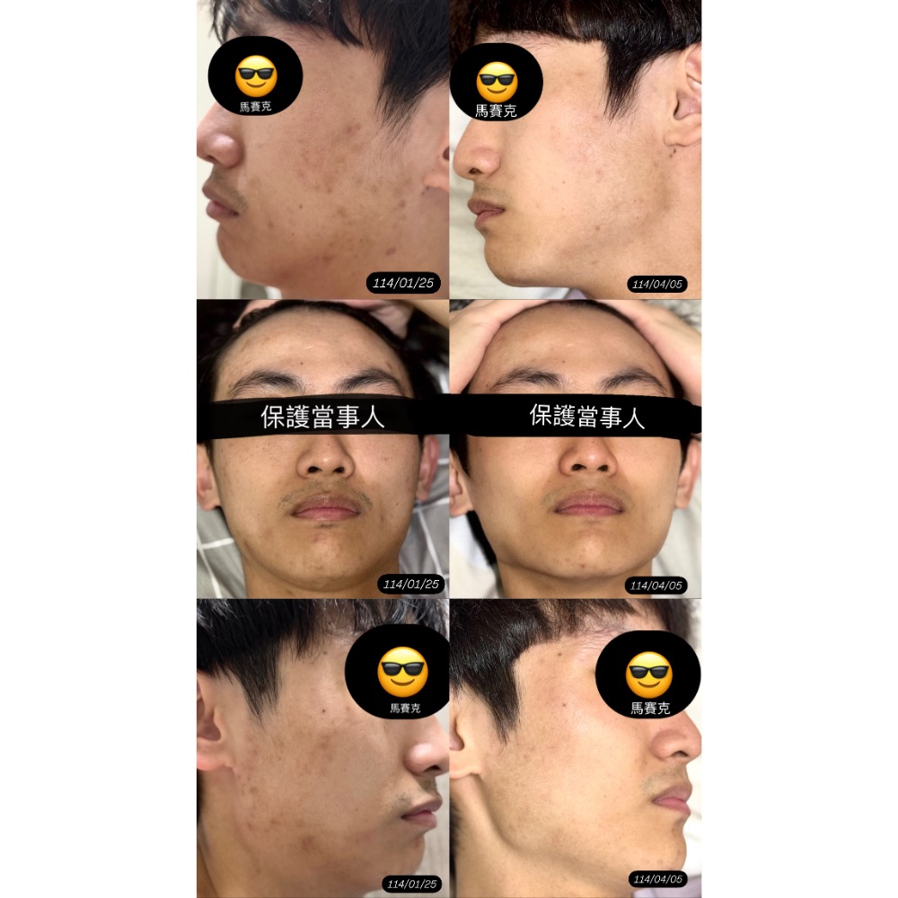 透亮冰晶膠原蛋白-細節圖3