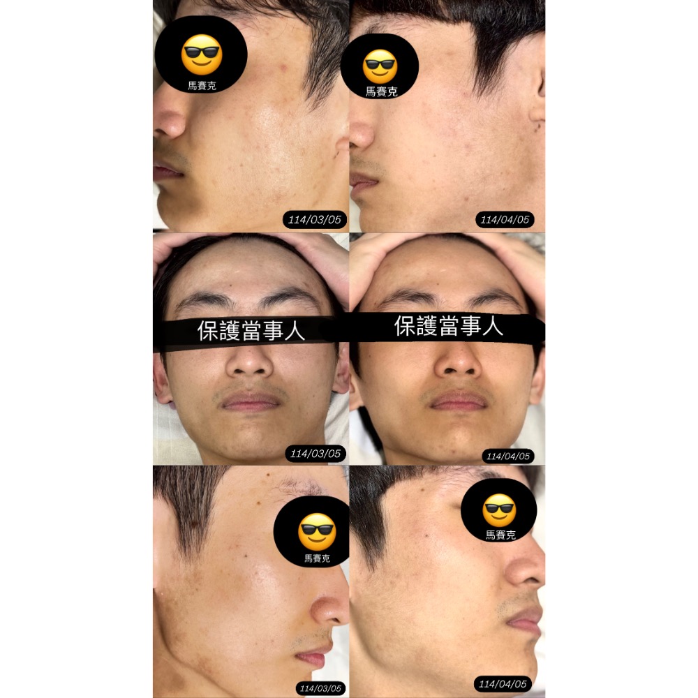 透亮冰晶膠原蛋白-細節圖4