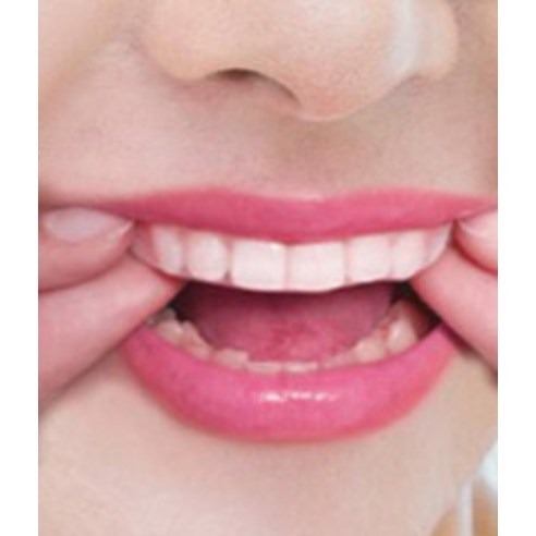 PERIOE 倍麗兒 White Now亮白貼 8入-細節圖4