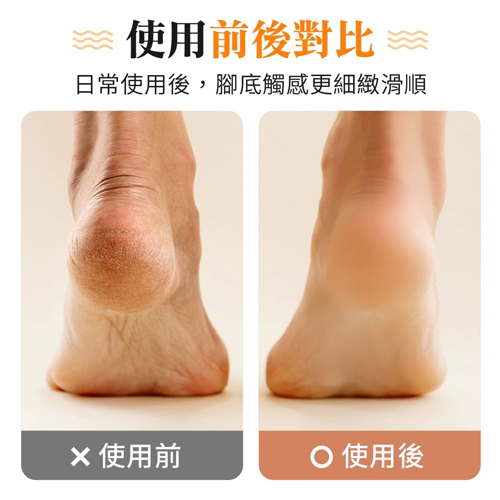 Mini電動磨腳皮機 電動磨腳器 迷你磨腳皮機 磨腳機 磨皮機 磨足機 磨腳皮機 電動磨腳皮 自動磨腳皮機 腳皮機-細節圖3