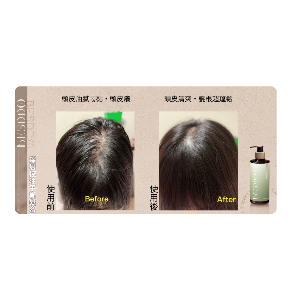 控油洗髮精推薦｜清爽蓬鬆 × 頭皮潔淨｜BESDDO 深層控油平衡髮浴-細節圖3