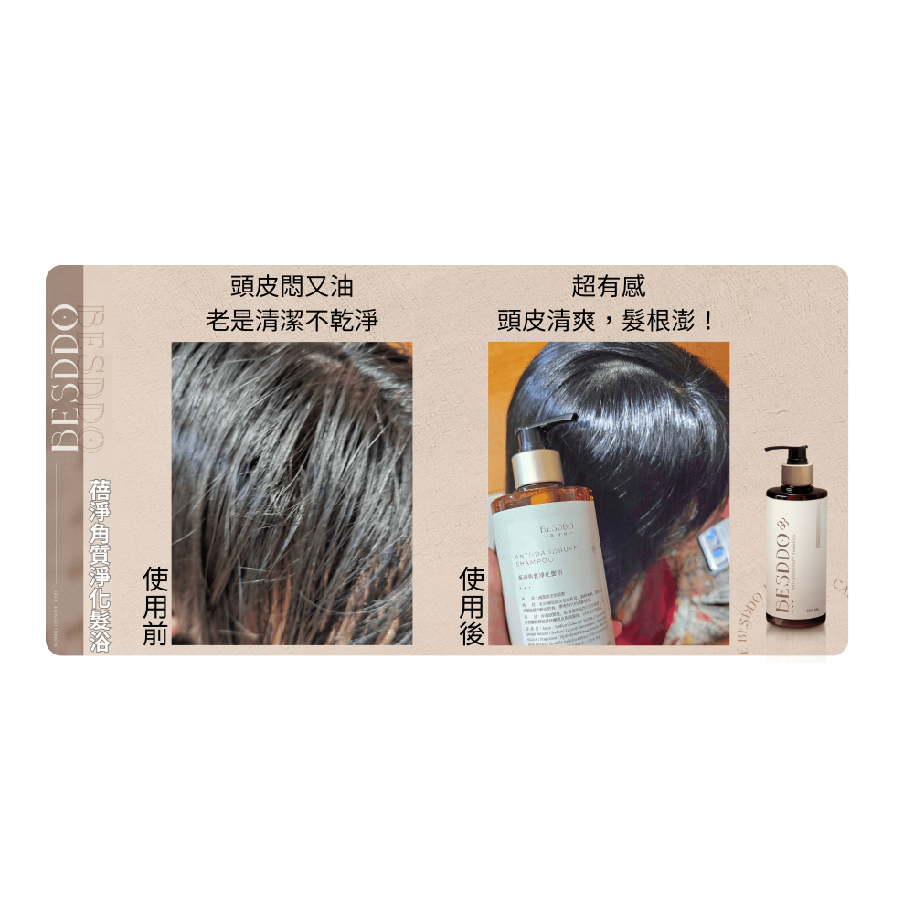 去屑洗髮精推薦｜控油清爽 × 頭皮屑調理｜蓓淨角質淨化髮浴 BESDDO-細節圖3