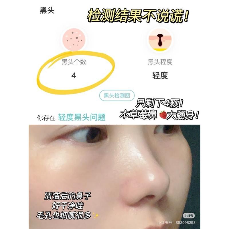 ilso 鼻貼 一盒五組 去黑頭導出貼 吸黑頭 毛孔深層清潔控油-細節圖5