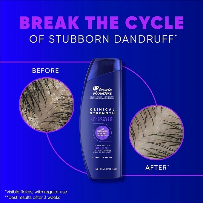 🙆‍♀️臨床強效去屑系列🙆🏻‍♂️美國皮膚科醫師推薦 Head & Shoulders 海飛絲臨床強效去屑洗髮精-細節圖4