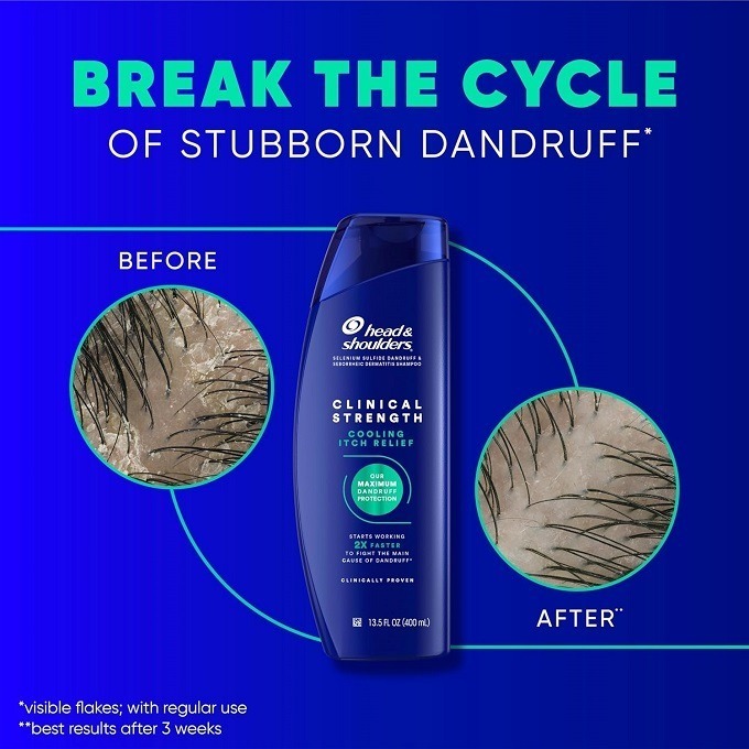 🙆‍♀️臨床強效去屑系列🙆🏻‍♂️美國皮膚科醫師推薦 Head & Shoulders 海飛絲臨床強效去屑洗髮精-細節圖7