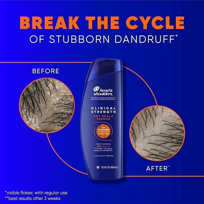 🙆‍♀️臨床強效去屑系列🙆🏻‍♂️美國皮膚科醫師推薦 Head & Shoulders 海飛絲臨床強效去屑洗髮精-細節圖10