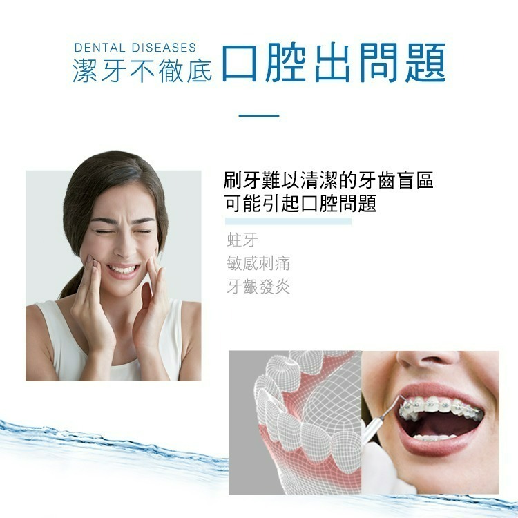 【Oral-B 歐樂b】手持 高效 活氧沖牙機 MDH20 沖牙器-細節圖4