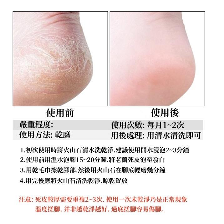 🔴現貨 雙面磨腳石 搓腳石 磨腳器 搓腳板 去死皮 腳後跟磨石 磨腳工具-細節圖8