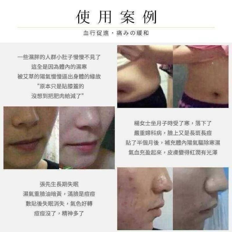 【粿女兒商行】🔥現貨 淨森堂 溫感艾灸貼 10片入-細節圖7