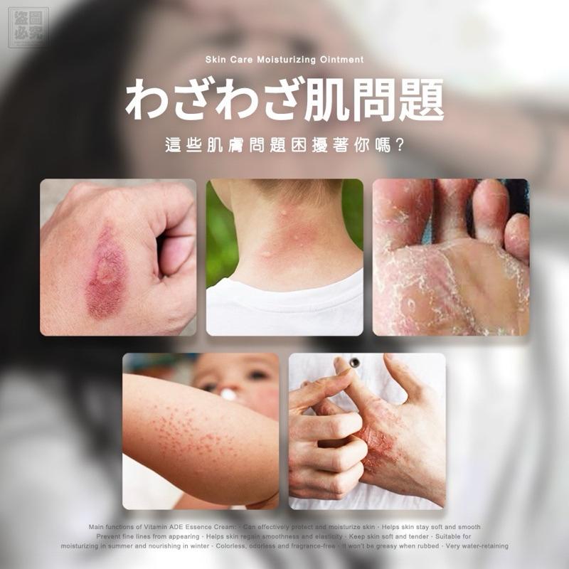 【粿女兒商行】🔥現貨 萬用ADE乳霜50ML 二代PLUS加強版  🏆家家戶戶必備-細節圖2
