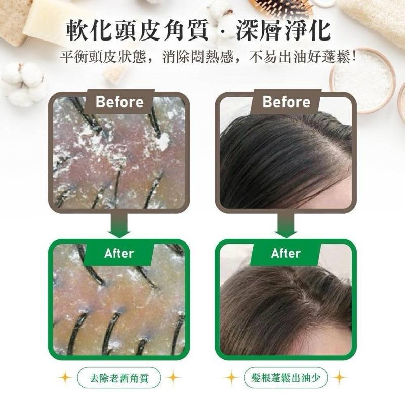 【粿女兒商行】🔥現貨 韓國원인미-積雪草B5頭皮去角質慕斯450ml-細節圖6