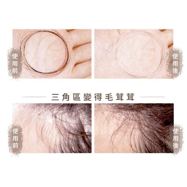 THE VITA 頭皮調理液110ml-細節圖4