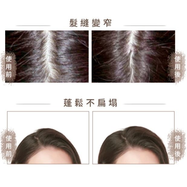 THE VITA 頭皮調理液110ml-細節圖5