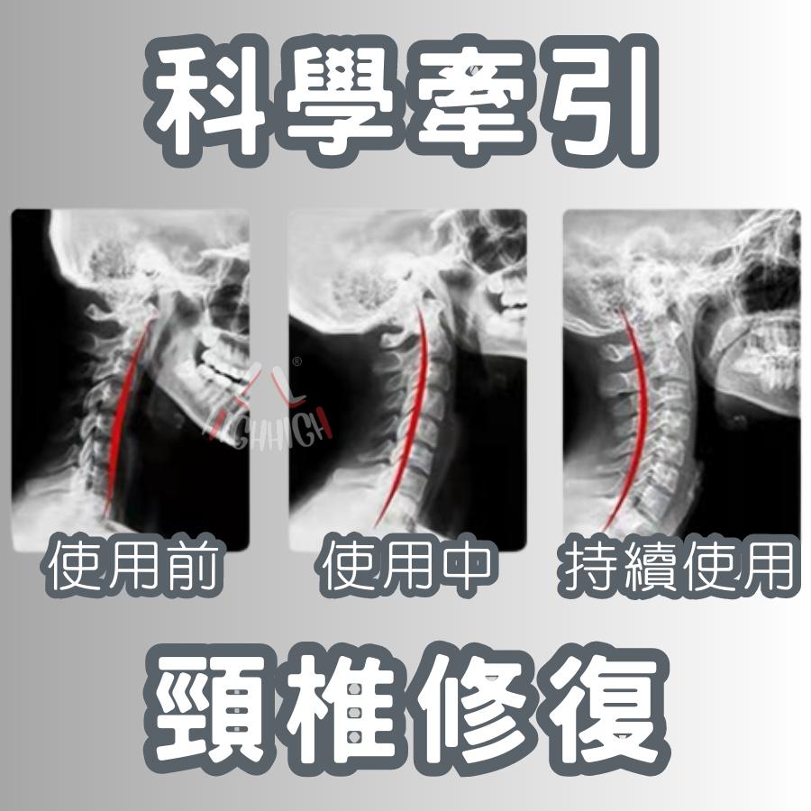 『現貨秒發蝦皮最低價💥』頸椎矯正枕 頸椎按摩枕 重力指壓頸部按摩 頸椎支撐枕 修復脖子反弓 變直 富貴包 頸椎牽引-細節圖7