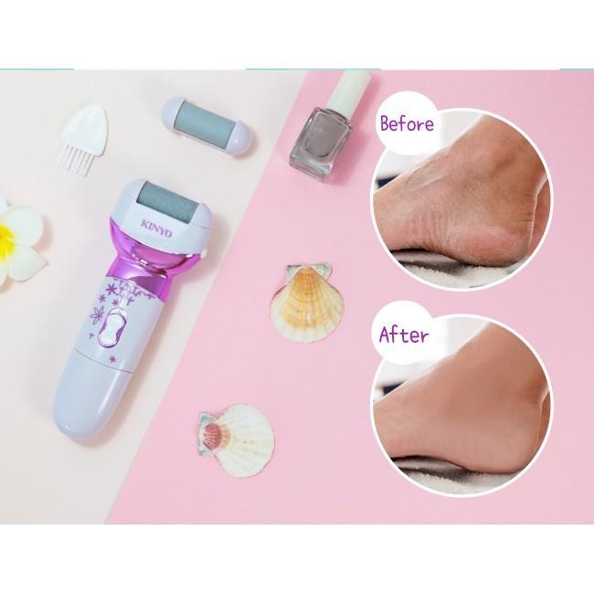 含稅全新原廠保固一年KINYO全水洗電池式去角質美足機(BT-281)-細節圖8