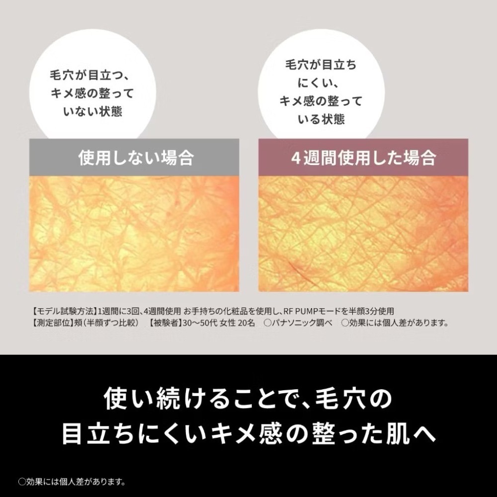 現貨免運【Panasonic】國際牌 Vitalift EH-SR86｜🇯🇵日本製｜內附Smooth Lift凝膠-細節圖6