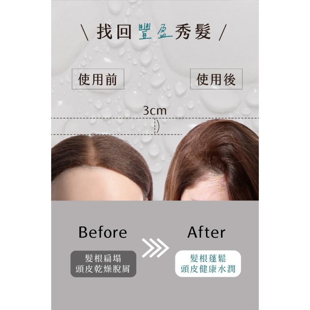 全新正品香水人生｜5α高濃縮養髮精華40ML-細節圖2