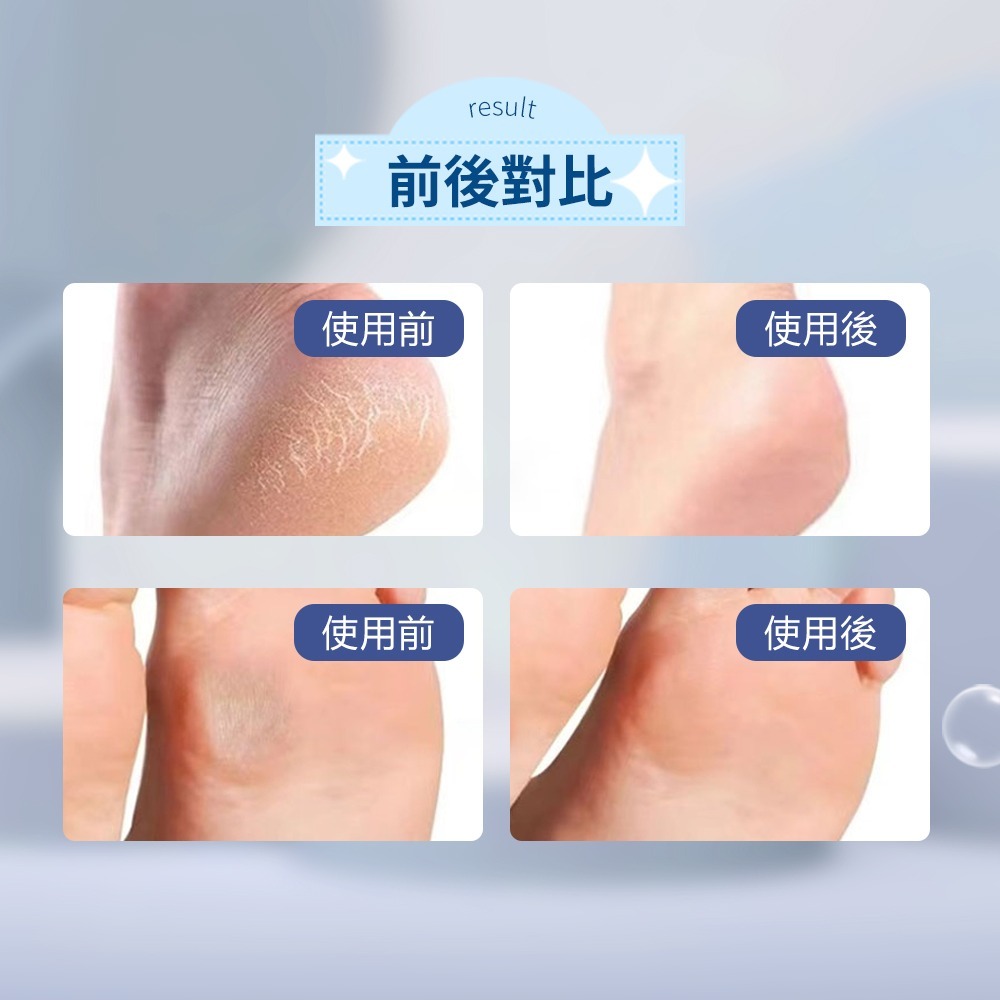 【奈米玻璃磨腳器】磨腳石 去腳皮 去腳皮神器 磨腳器 足部護理 磨腳器 足部去角質 去腳皮刀 磨腳皮器-細節圖4