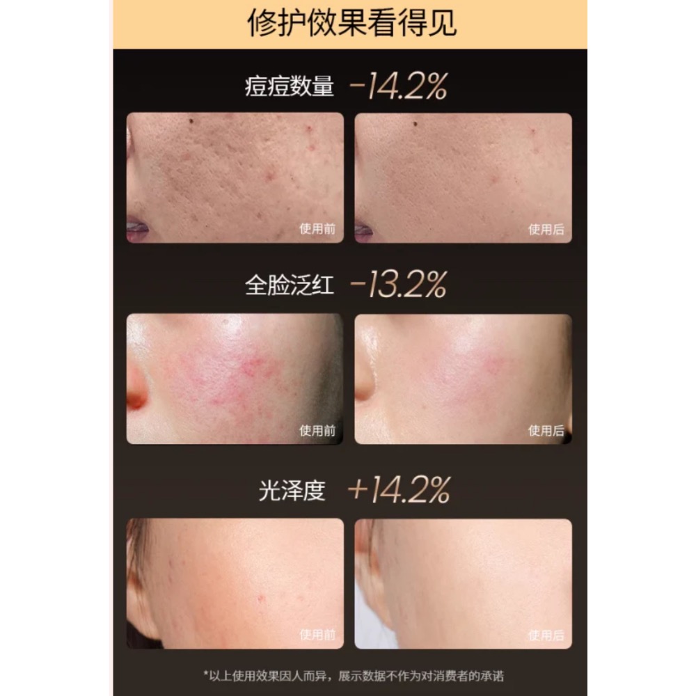 💡Beauco LED 光療美容面罩｜你的居家光子護膚師 ✨-細節圖5
