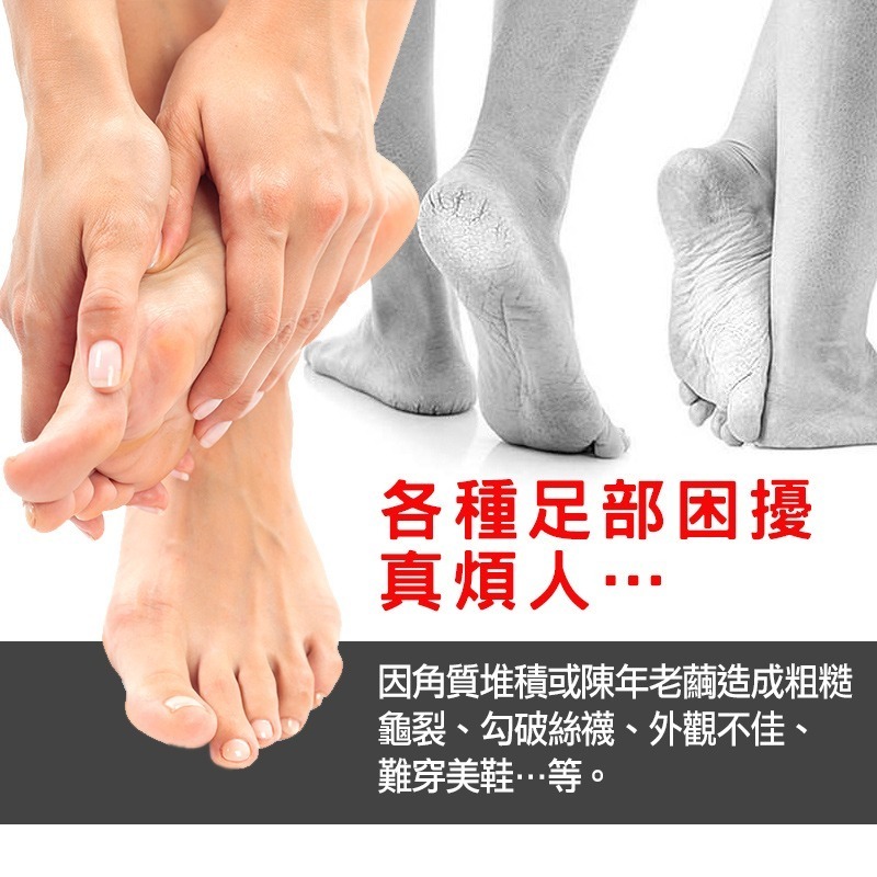 INSIST旗艦版 電動磨腳皮機 磨腳皮 磨腳皮機-細節圖3