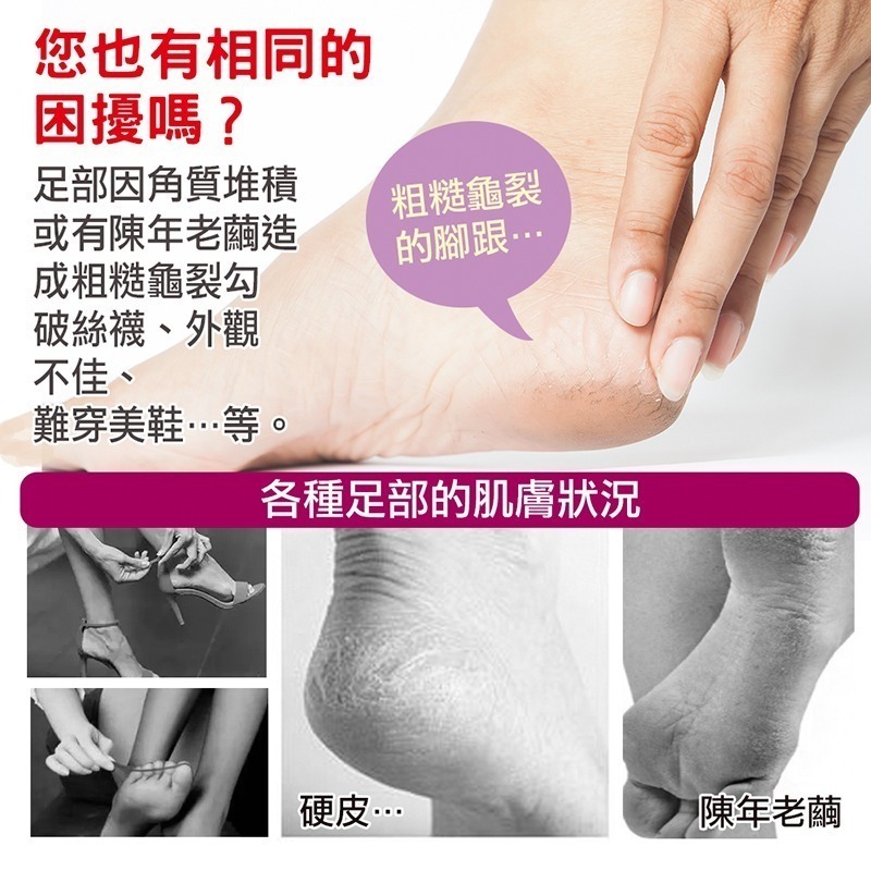 不鏽鋼磨腳皮器 去腳皮 磨腳皮 1入-細節圖2