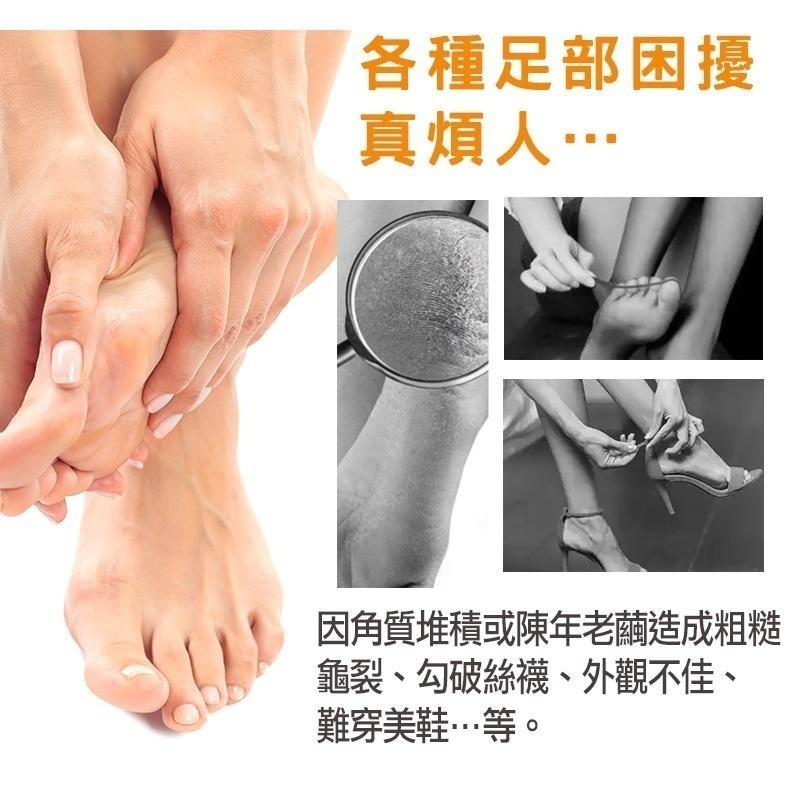 【INSIST】磨腳皮機 腳皮機 磨腳皮 去腳皮 腳皮 去角質 不銹鋼足部保養套組 8件組 10件組-細節圖2