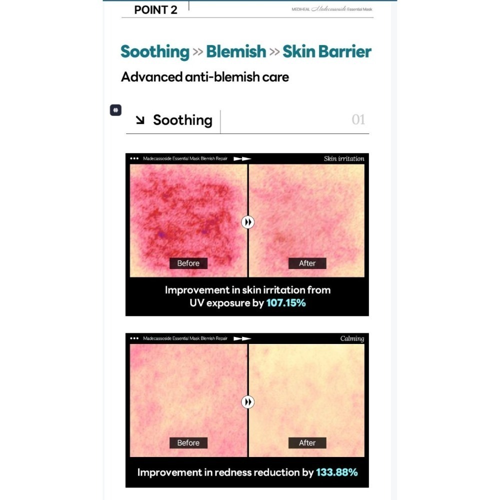 MEDIHEAL 積雪草苷精華面膜 淡斑修補-細節圖4