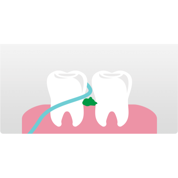[ 好市多costco代購 ]3M 護牙牙間刷 L型 144支-細節圖6