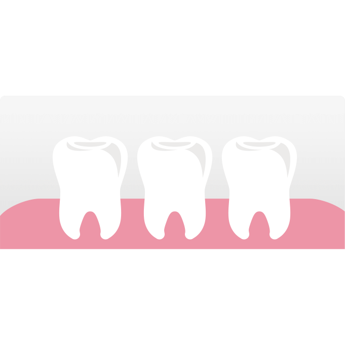 [ 好市多costco代購 ]3M 護牙牙間刷 L型 144支-細節圖7