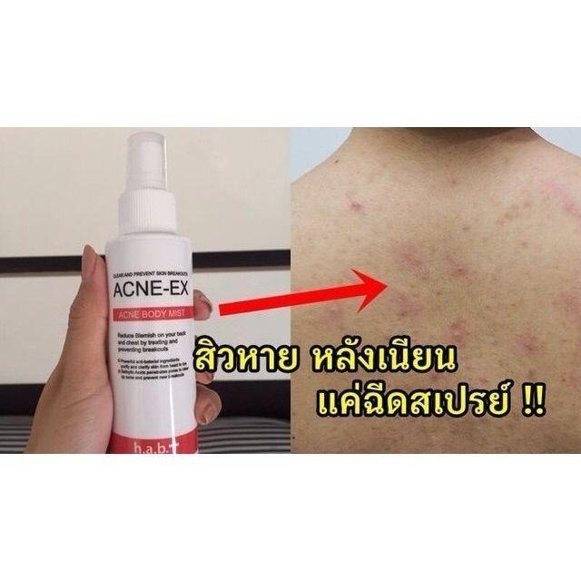 現貨 正版公司貨中文標已登錄 ACNE-EX Acne Body Mist 身體淨痘調理噴霧 120ml-細節圖5