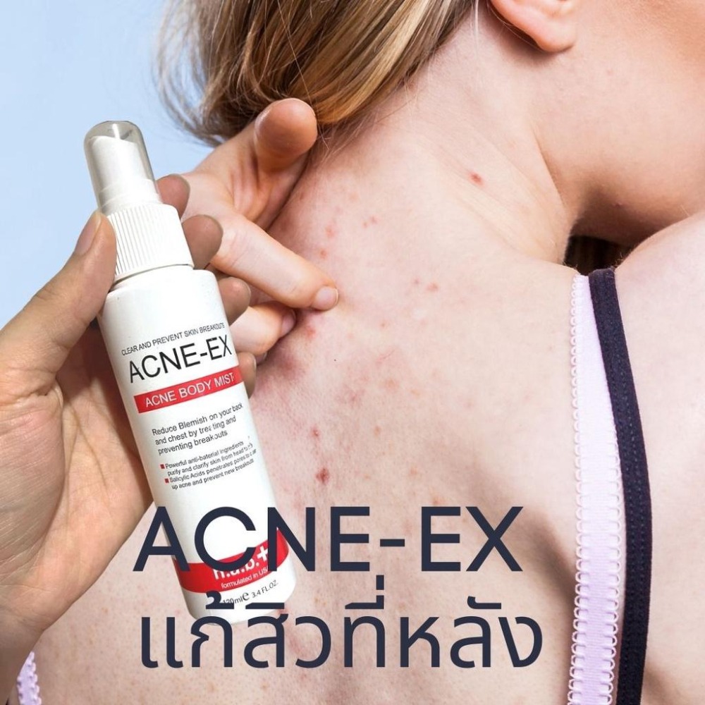 現貨 正版公司貨中文標已登錄 ACNE-EX Acne Body Mist 身體淨痘調理噴霧 120ml-細節圖2