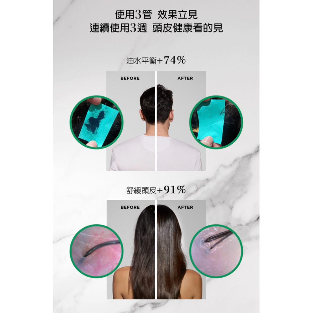 栗子美妝🌰｜巴黎卡詩 專櫃中文標 極酵平衡頭皮精華 極淨平衡頭皮精華 90ml KERASTASE 全新正貨 現貨-細節圖4