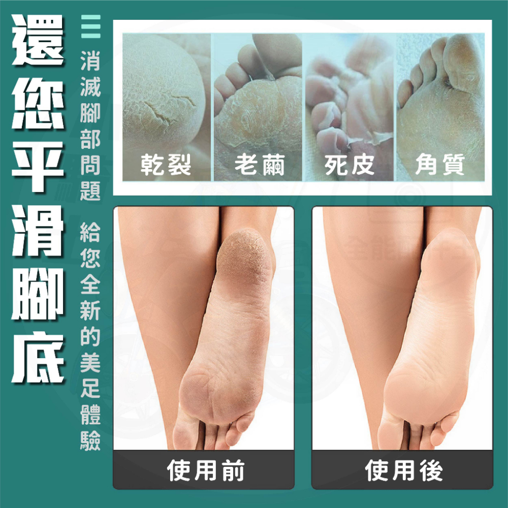[24H發貨][台灣現貨] 腳皮刀【送10刀片】刮腳器 去腳皮 搓腳皮 腳皮刀片 腳皮器 磨腳皮器 居家用品 生活-細節圖2