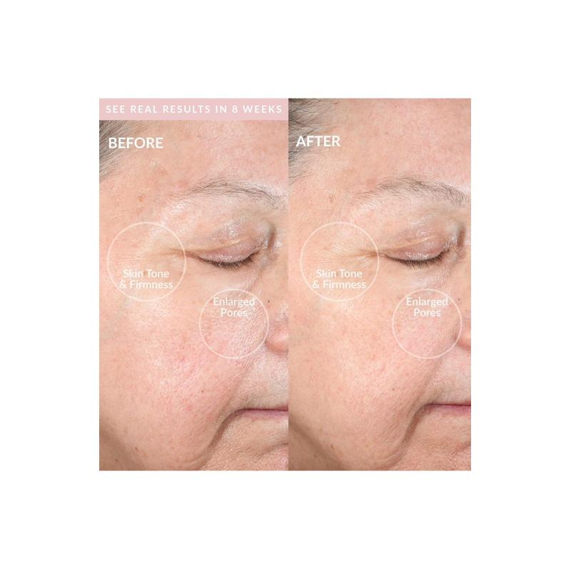 [福利品出清］PMD 潔顏超導晶石美膚儀Clean Pro導入儀洗臉機-細節圖3