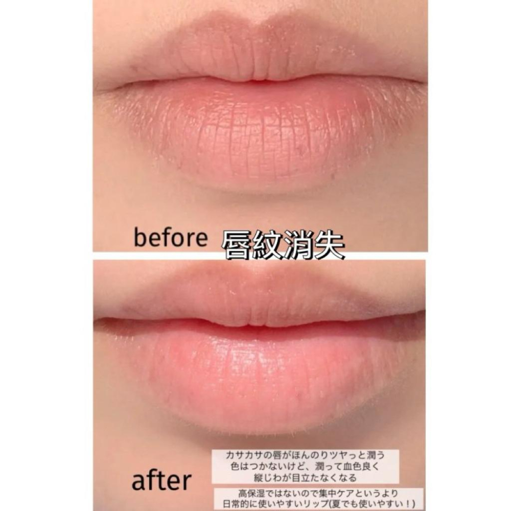 MU 現貨 【REJURAN 麗珠蘭】舒緩保濕潤唇膏3.7g-細節圖4