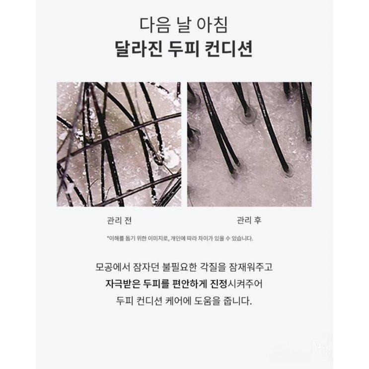 MU 現貨 【韓國GROWUS】珍珠粉損傷修護頭皮安瓶50g-細節圖4