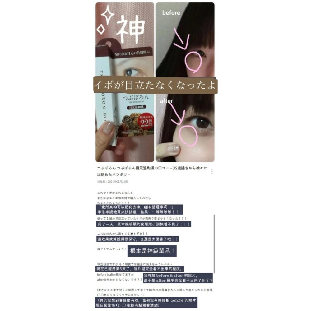 MU 現貨 【TSUBUPORON】去小肉芽角質粒美容膏(夜用)20g 去眼部油脂粒美容膏1.8ml-細節圖9