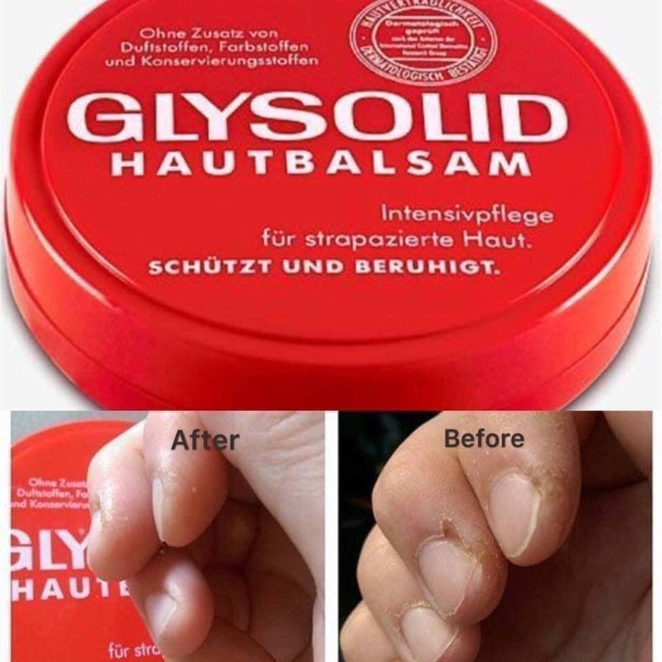 附發票 德國 GLYSOLID 神奇乳霜100ml-細節圖2