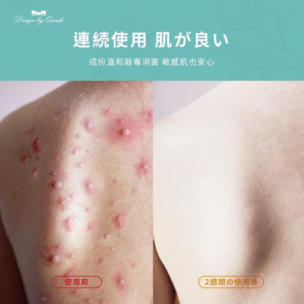 [現貨 快速出貨]白茶尤加利除螨香水沐浴乳(大容量800ml) 沐浴乳 除螨沐浴乳-細節圖7